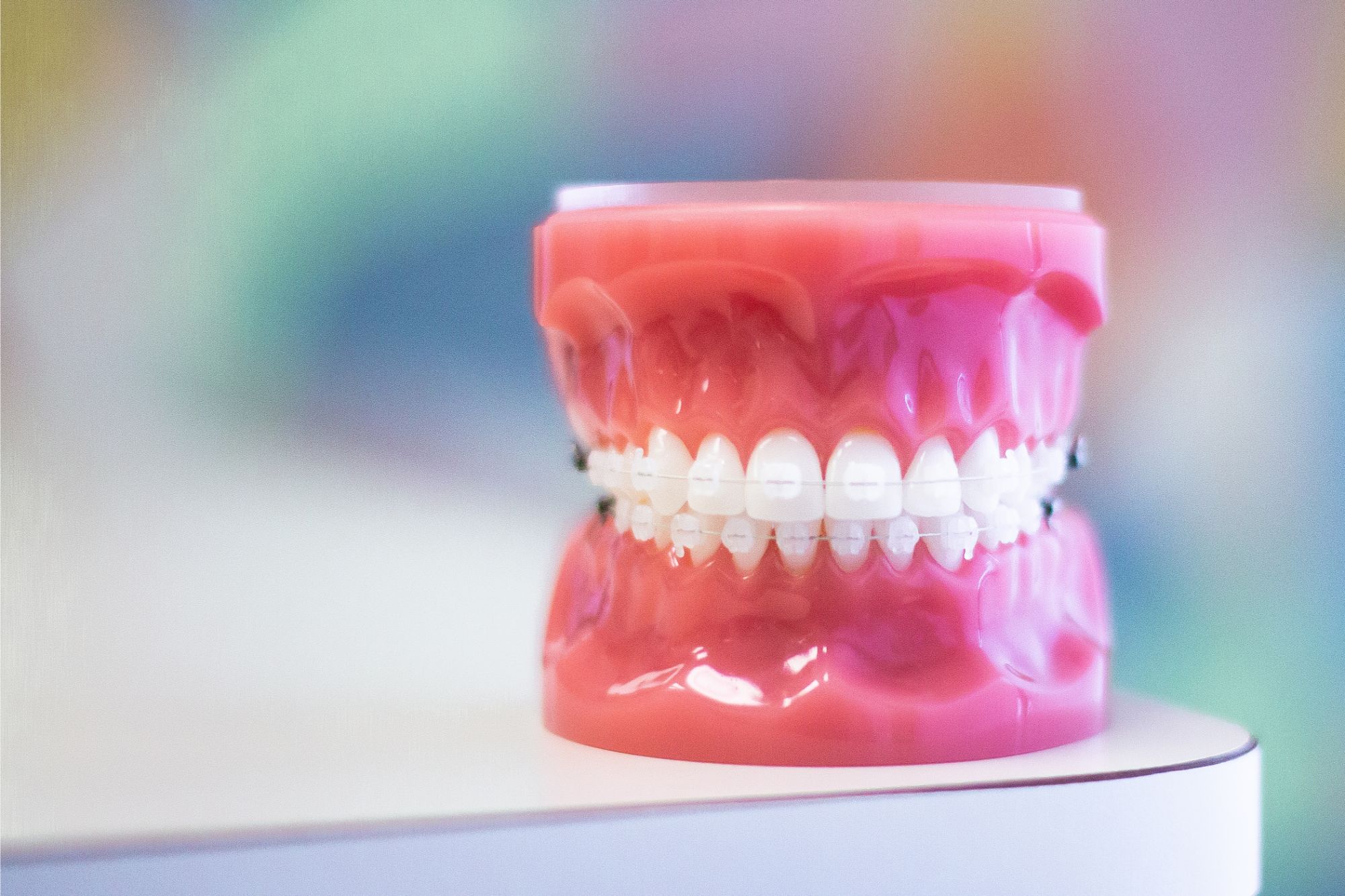 teeth model with clear braces