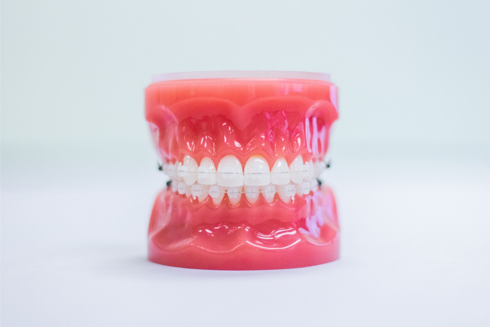 clear braces teeth model